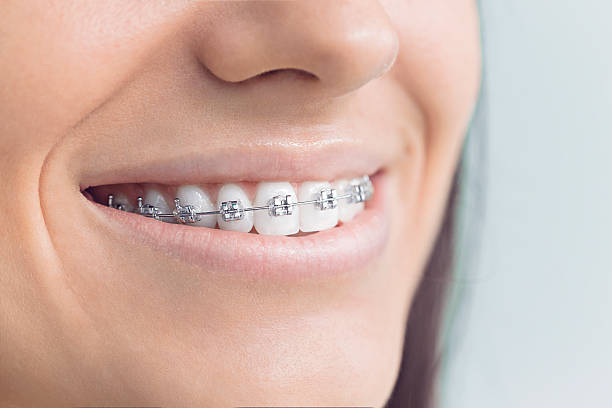Best Tooth Extraction  in Bellevue, MI